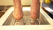 Zwei nackte Füße stehen auf einem Scanner. Sie sind von hinten zu sehen. Oberhalb der rechten ferse ist eine mehrere Zentimeter lange Narbe ersichtlich. 